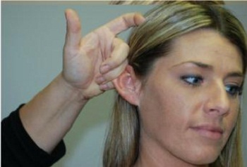 Proper hold of the right pinna when attempting to use an otoscope as the light source for cerumen removal