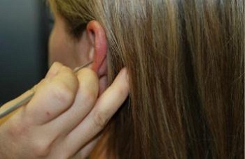 Proper bracing for right-handed cerumen removal on the left ear