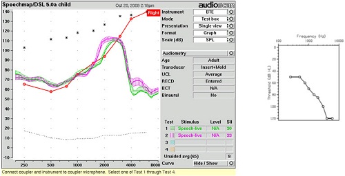 Live speech stimuli verification of s and sh for a listener with moderate sloping to profound hearing loss