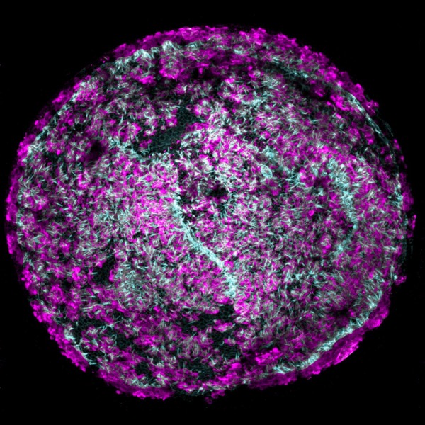 Photograph of large clonal colonies of cochlear progenitor cells