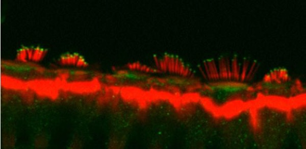 stereocilia bundles on inner hair cells
