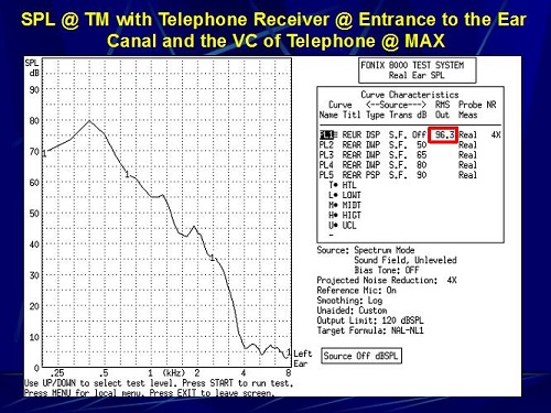 Sound pressure level at the eardrum with the telephone receiver coupled to the entrance of the ear canal and volume of the telephone set to maximum