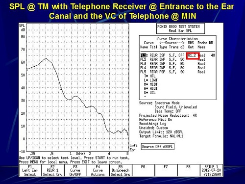 Sound pressure level at the eardrum with the telephone receiver coupled to the entrance of the ear canal and volume of the telephone set to minimum