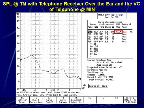 Sound pressure level at the eardrum with the telephone receiver over the ear and the volume of the telephone set to minimum