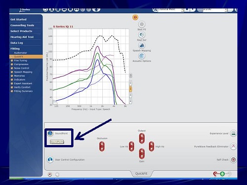 Starkey software screen shot