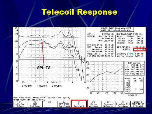 Telecoil response in the Frye test box
