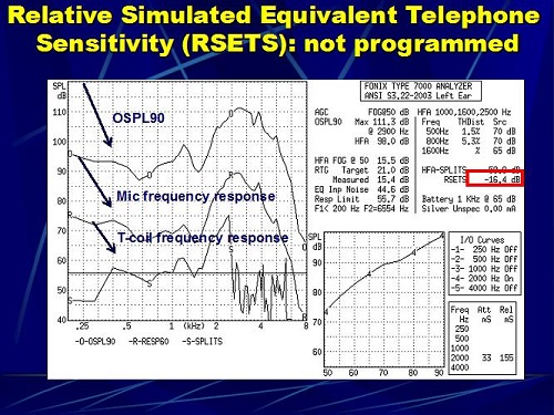 RSETS in a hearing aid where the telecoil was not programmed
