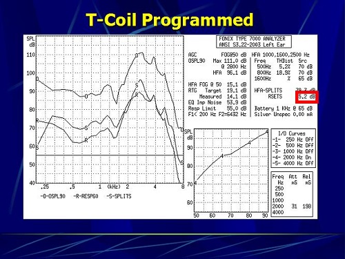 The same hearing aid in which the telecoil was programmed