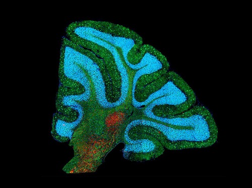 Niemann-Pick disease type C1, a lipid storage disorder, as seen in a mouse cerebellum