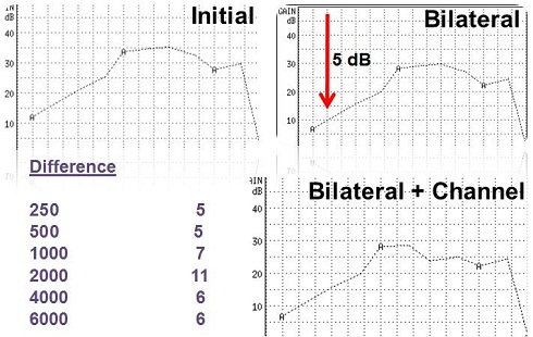 Corrections for bilateral and channel summation