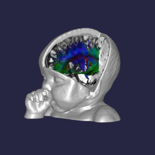 artwork showing a few of the connections in the brain of a typically developing 6-month infant who participated in the study