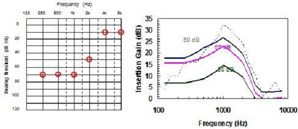 Comparison of NAL-NL2 to NAL-NL1 prescriptions for a reverse-slope hearing loss