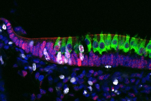 One of the two proteins, Sox4, appears at the outer edge of the developing utricle, and occasionally within the nuclei of new hair cells