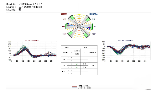 vHIT results in a partially compliant 11 month old male