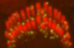 Immunofluorescence of TMC2 in confocal images of mice inner hair cell stereocilia