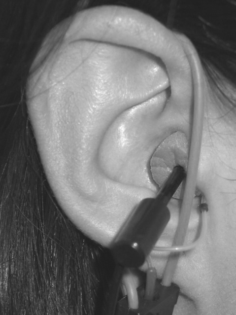 Setup for the real-ear-to-coupler difference measurement on the Audioscan and subsequent insertion of foam ear tip