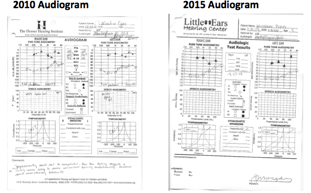Winslow&rsquo;s audiogram