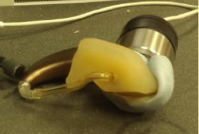 BTE with earmold attached to HA1 coupler using putty