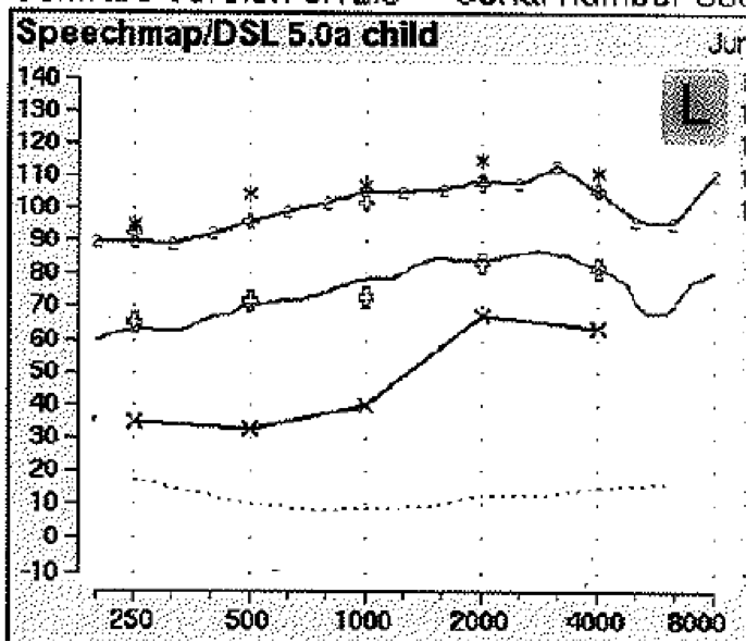 Curves demonstrating that a notch in the high frequency region of verification curves may result