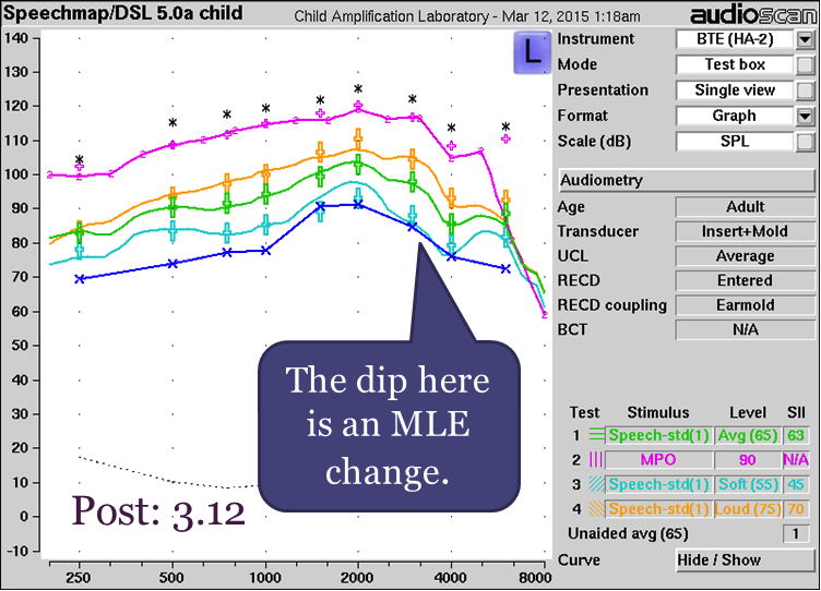 Coupler verification pre- versus post the new RECD standard with BTE
