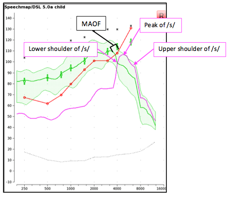 The aided LTASS measured using a presentation level of 65 dB SPL