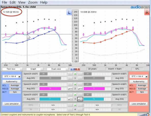 Obtaining output numbers via graph display using the cursor
