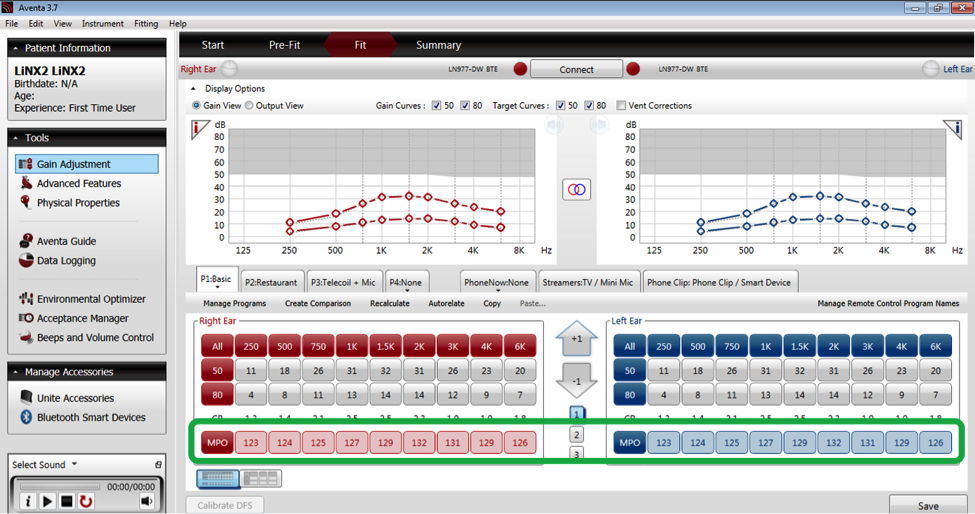 Hearing instrument Fit screen in Aventa 3.7
