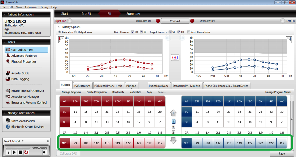 Hearing instrument Fit screen in Aventa 3.8 and later