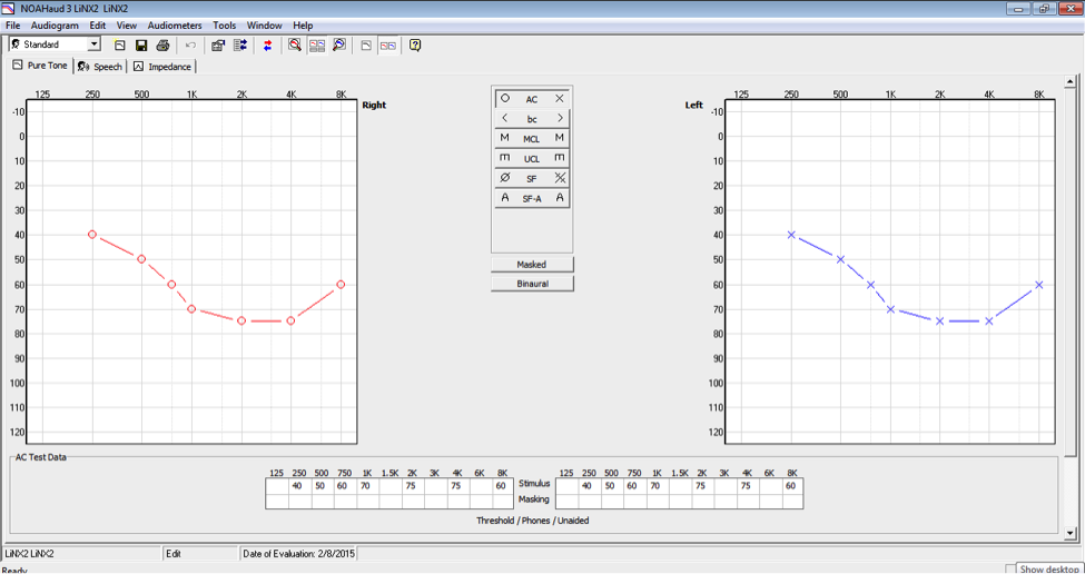 Audiogram in NOAH