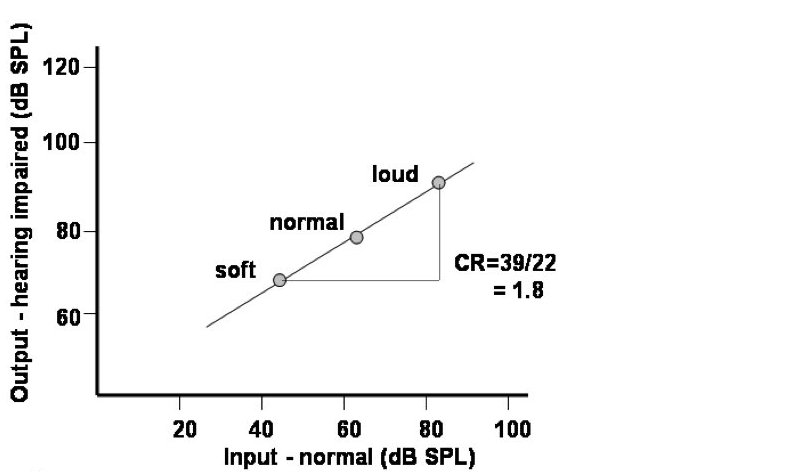 Determining compression ratio, hearing impaired