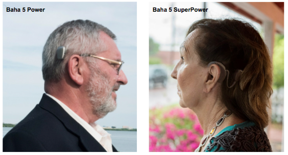 Baha Connect System