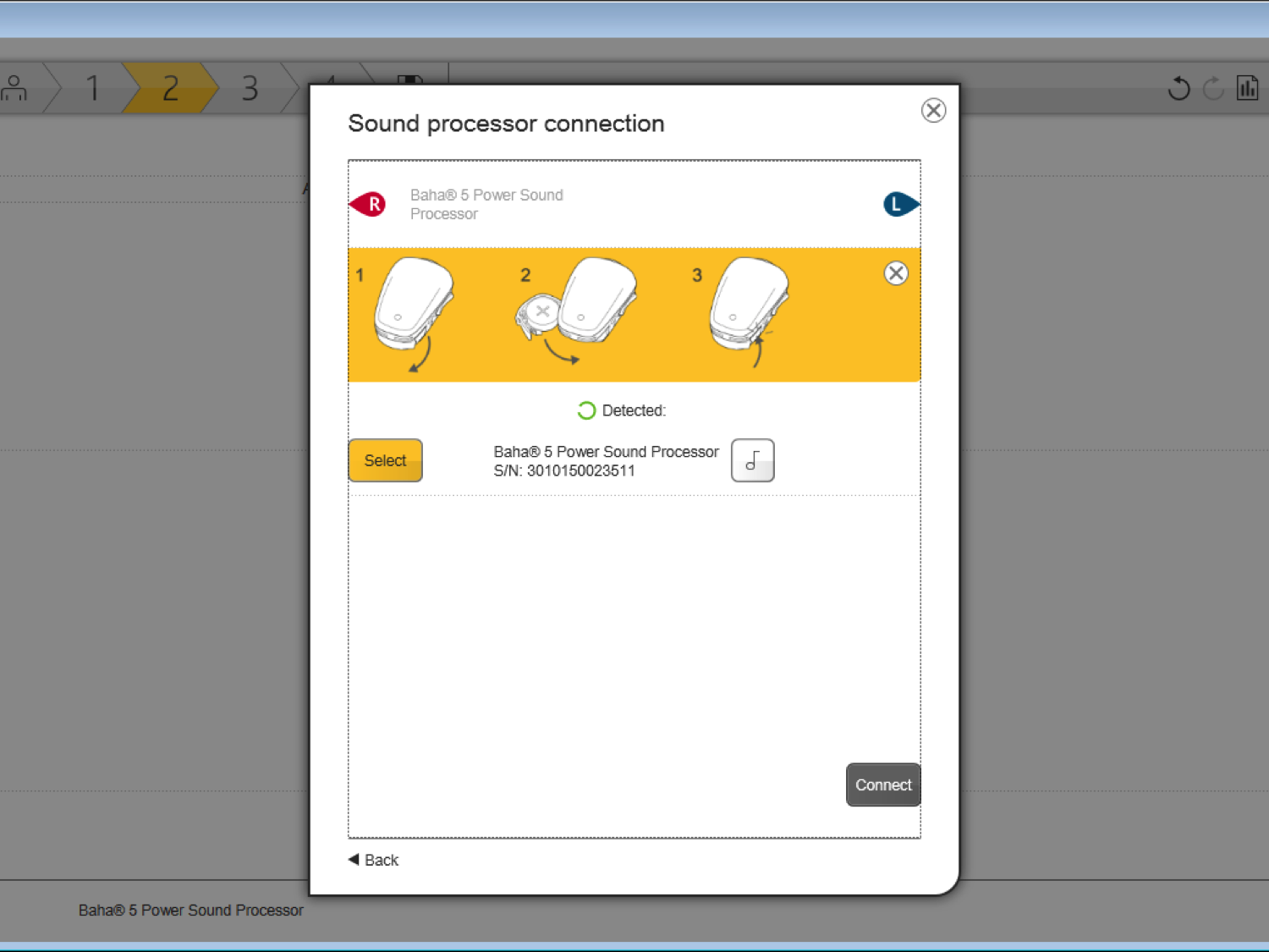 Sound processor connection setup