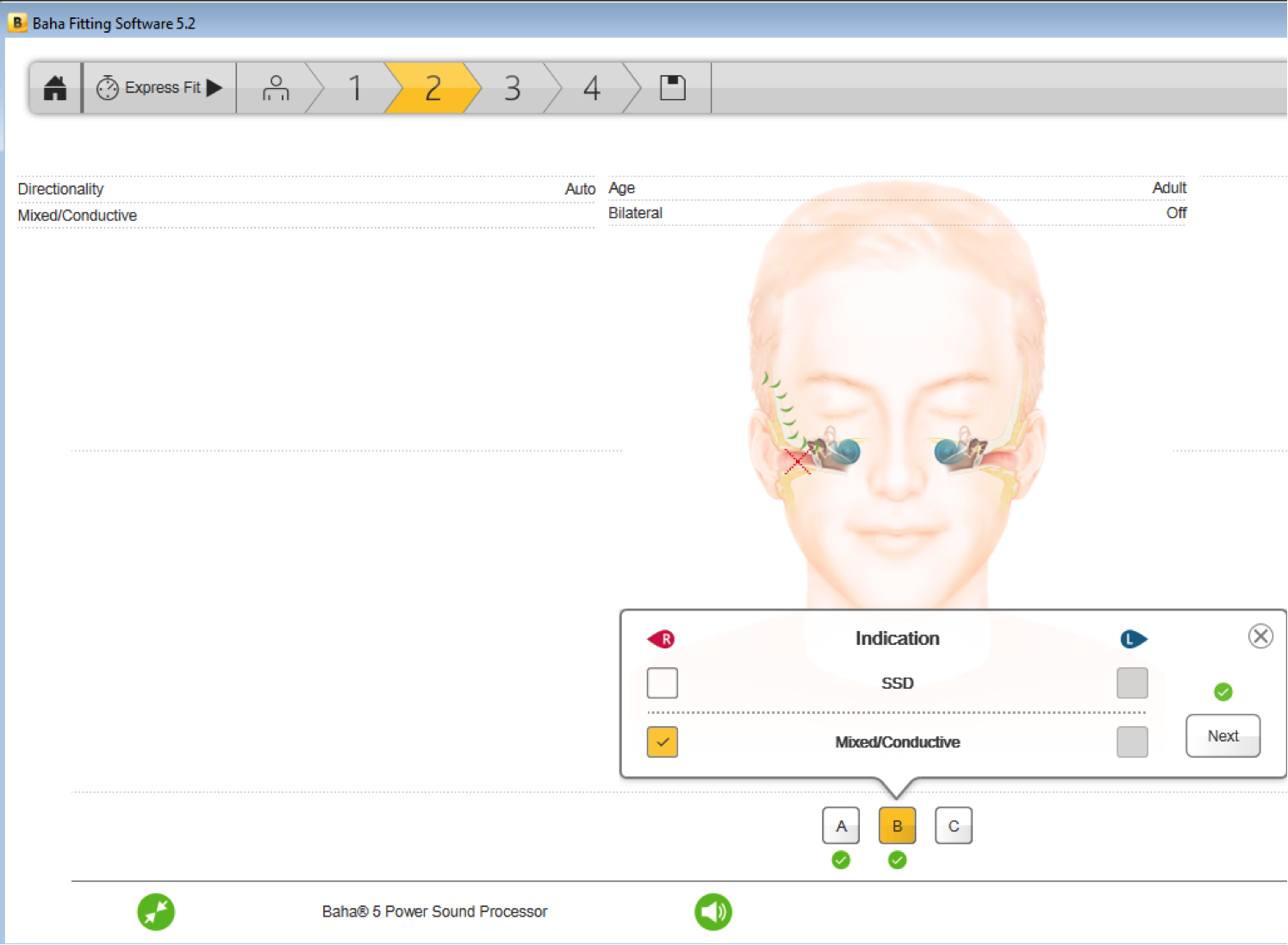 Select hearing loss type