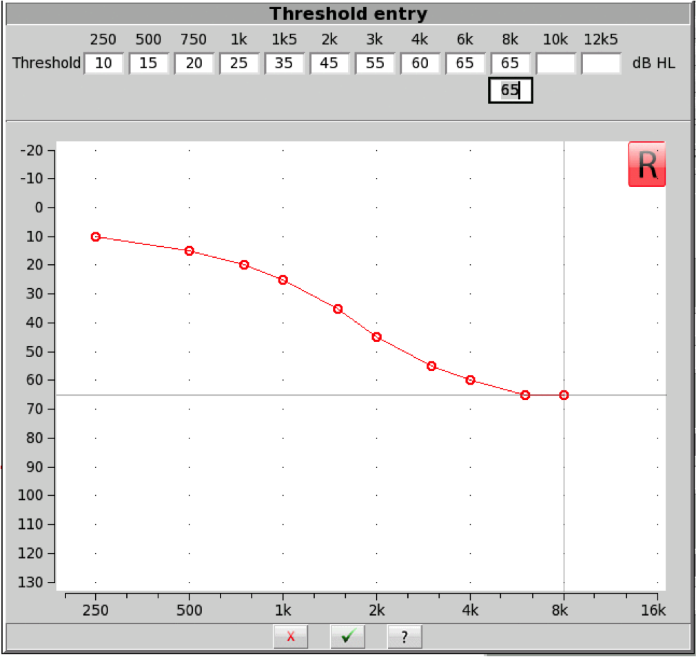 Patient&rsquo;s audiogram used for open fit candidacy procedure