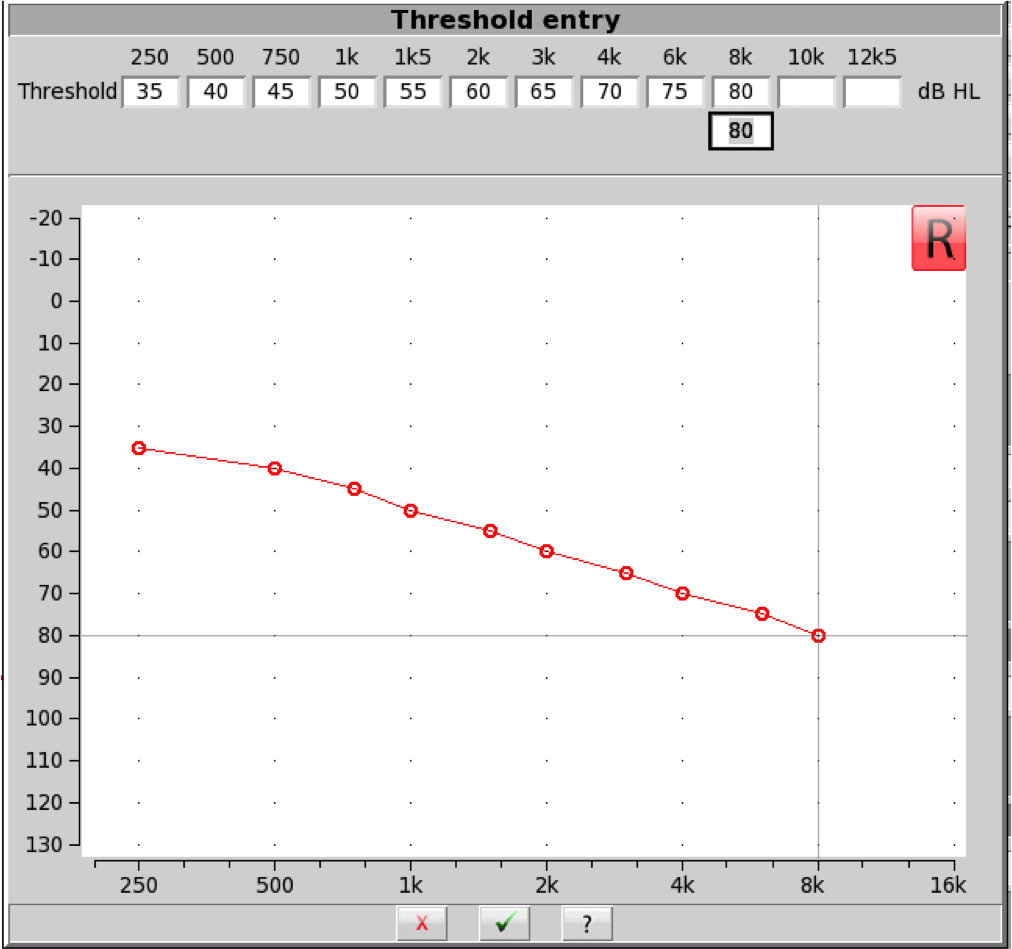 Audiogram for Example 2