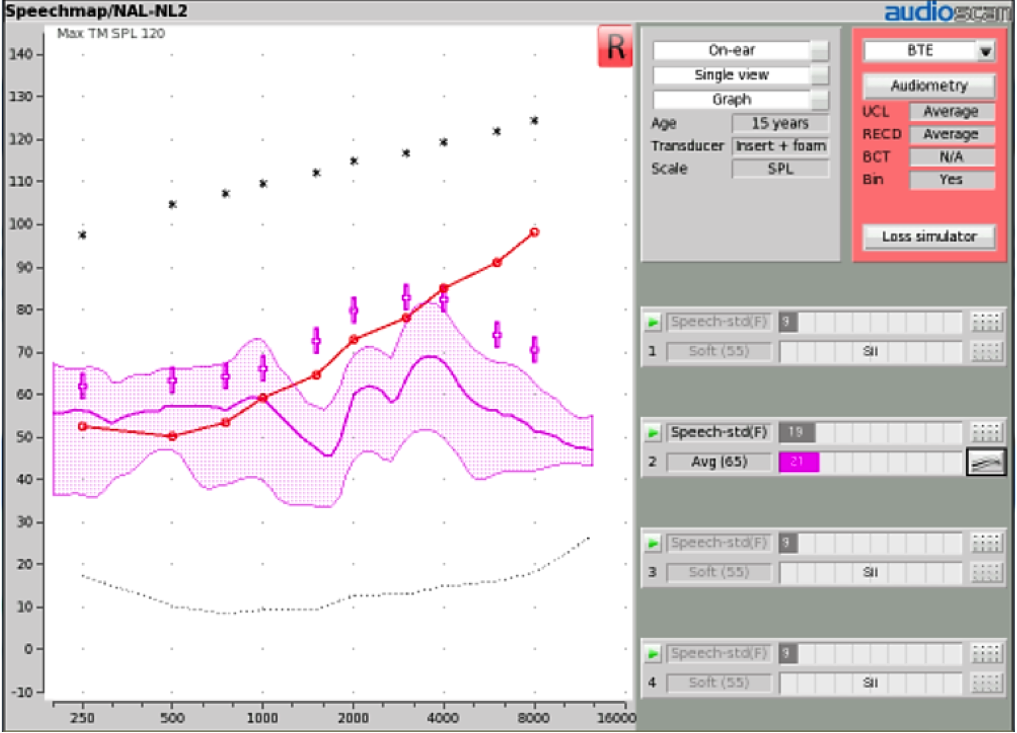 Determining open fit candidacy