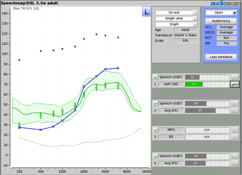 Test 1 Calibrated soft speech
