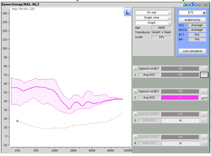 REOR On-ear result obtained when the probe tube and a muted RIC instrument is in the ear canal
