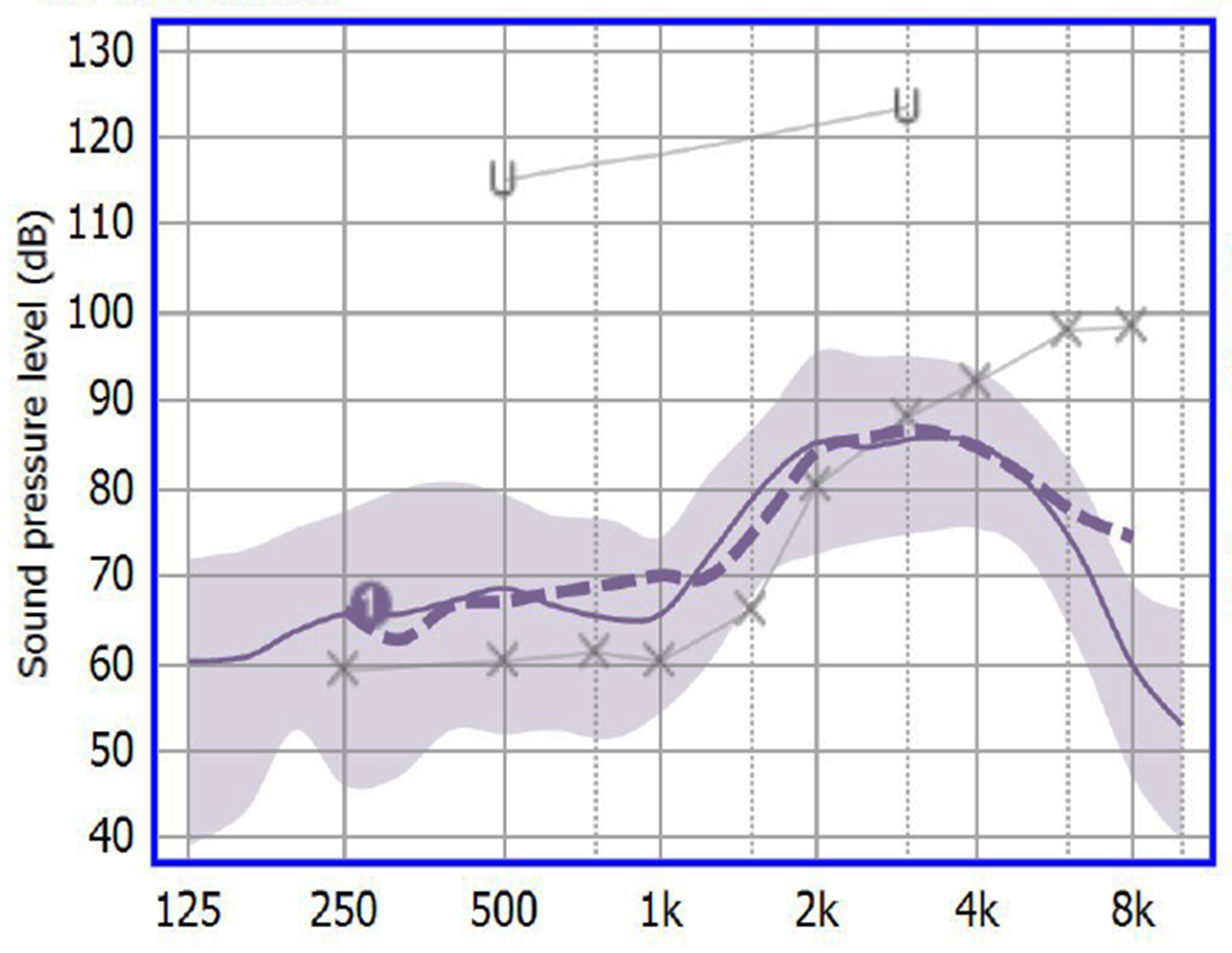 Aided speech mapping results
