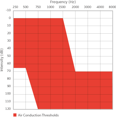 Audiogram showing EAS candidacy