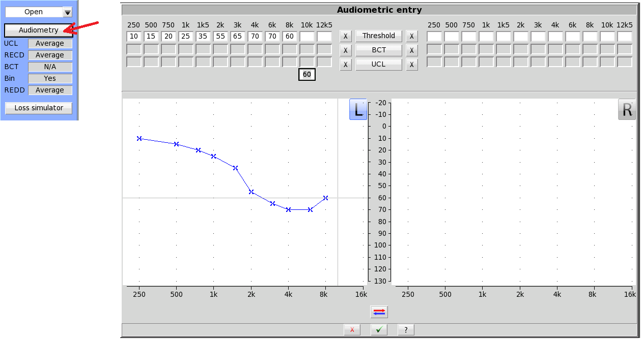 Verifying aided performance on-ear. Entering the dB HL audiogram into Speechmap