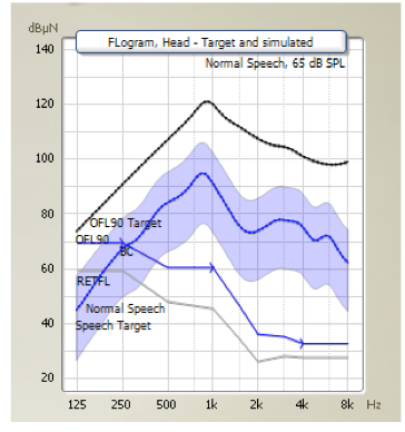 FLogram with Normal hearing reference
