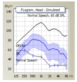 FLogram in Genie Medical