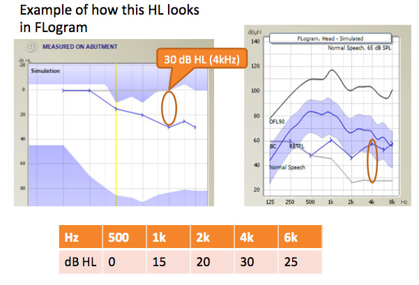 Example of how a mild sloping hearing loss looks in FLogram