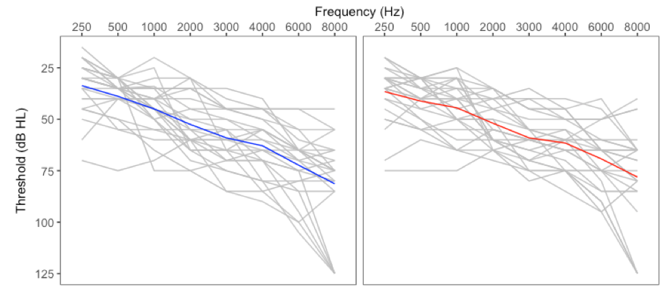 Pure-tone air condition audiometric thresholds for all participants