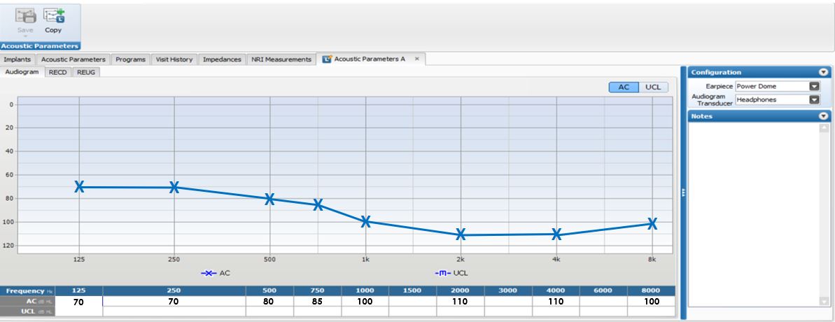 Acoustic Parameters Tab