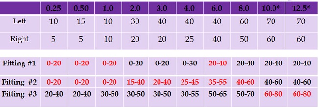 Example of fitting profile selection for a patient with normal sloping to severe hearing loss