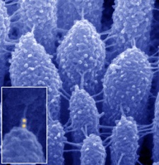 Scanning electron microscopy image illustrates tiny extracellular links between stereocilia of an inner ear hair cell