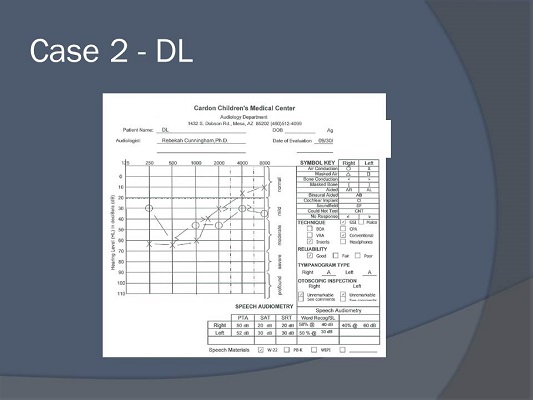 Audiometric data for case study DL