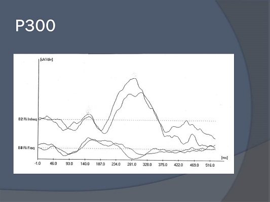 P300 response